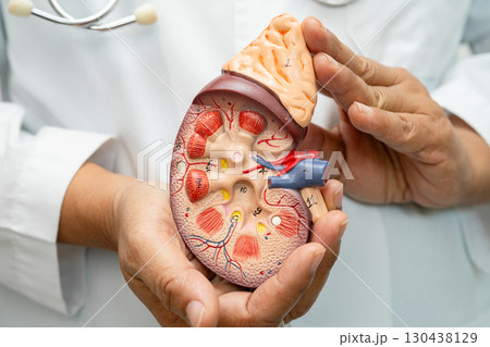 Kidney disease, Chronic kidney disease ckd, Doctor hold human model to treat and study in hospital. Kidney disease, Chronic kidney disease ckd, Doctor hold human model to treat and study in hospital. 130438129