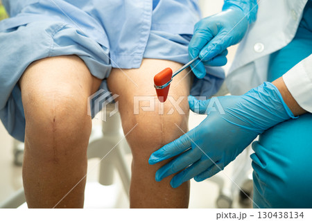 Asian doctor physiotherapist examining, massaging and treatment knee and leg of senior patient in orthopedist medical clinic nurse hospital. Asian doctor physiotherapist examining, massaging and treatment knee and leg of senior patient in orthopedist medical clinic nurse hospital. 130438134