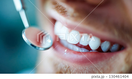 Close-up of a healthy male smile with shiny white teeth and dental mirror during a dental check-up Close-up of a healthy male smile with shiny white teeth and dental mirror during a dental check-up 130461404