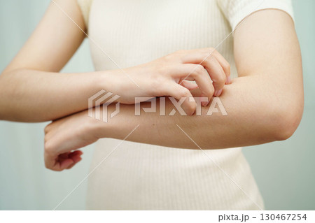 Asian woman itching of skin diseases using hand scratching. 130467254