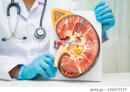 Chronic kidney disease, doctor with model for treatment urinary system, urology, Estimated glomerular filtration rate eGFR. 130473537