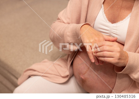 Pregnant woman massaging swollen fingers. Swollenness during pregnancy. 130485316