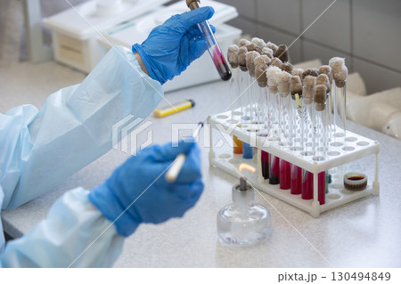 The hands of a physician laboratory assistant in an infectious disease laboratory examines the samples. The hands of a physician laboratory assistant in an infectious disease laboratory examines the samples. 130494849