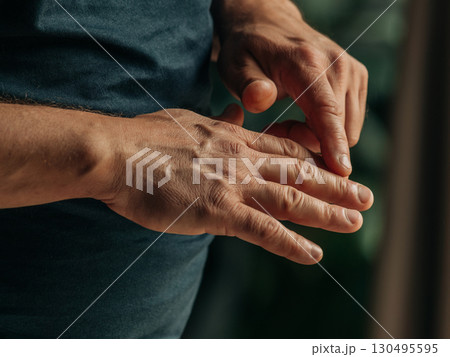 Close-up of a middle-aged man hands highlighting dry skin 130495595