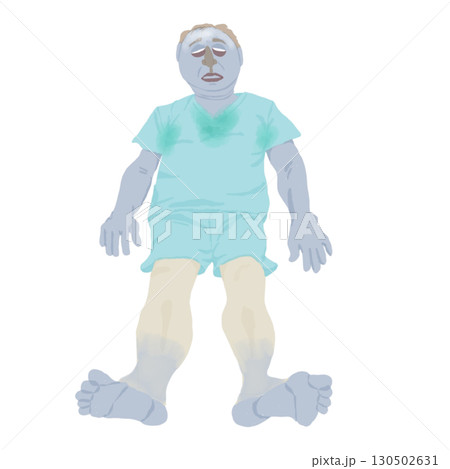 医療イラスト｜ショックの5P症状（蒼白・冷汗・脈拍微弱・虚脱・呼吸困難）教育用素材 130502631