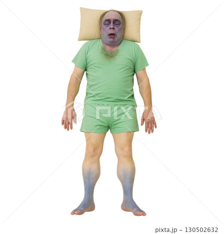 医療イラスト｜ショックの5P症状（蒼白・冷汗・脈拍微弱・虚脱・呼吸困難）教育用素材のイラスト素材 [130502632] - PIXTA