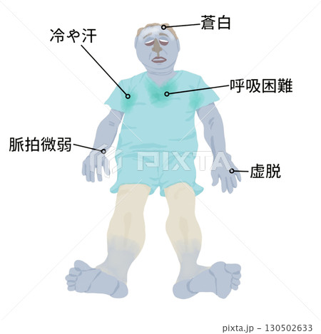 医療イラスト|ショックの5P症状(蒼白・冷汗・脈拍微弱・虚脱・呼吸困難)教育用素材 医療イラスト|ショックの5P症状(蒼白・冷汗・脈拍微弱・虚脱・呼吸困難)教育用素材 130502633