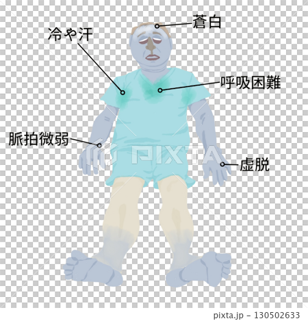 医療イラスト|ショックの5P症状(蒼白・冷汗・脈拍微弱・虚脱・呼吸困難)教育用素材 医療イラスト|ショックの5P症状(蒼白・冷汗・脈拍微弱・虚脱・呼吸困難)教育用素材 130502633
