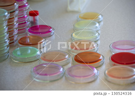 Bacterial colonies of streptococci with alpha hemolytics on a blood agar plate. Infection laboratory at the hospital. 130524316