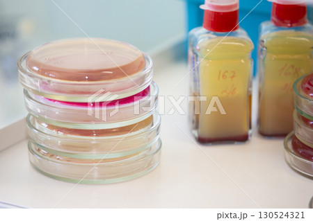 Bacterial colonies of streptococci with alpha hemolytics on a blood agar plate. Infection laboratory at the hospital. 130524321