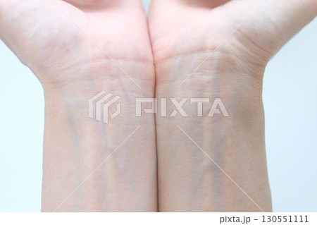 40代女性の両手首 130551111