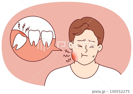 Tooth pain causes inflammation of cheek in suffering man who needs dental help or painkillers 130552275