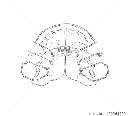 Orthodontic align teeth plate illustration 130563993