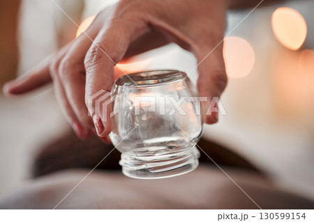 Cupping therapy, glass vacuum cup in hand and woman at spa, therapist with deep tissue massage and wellness. Closeup, treatment at luxury resort with cosmetic, body care and health with acupuncture Cupping therapy, glass vacuum cup in hand and woman at spa, therapist with deep tissue massage and wellness. Closeup, treatment at luxury resort with cosmetic, body care and health with acupuncture 130599154