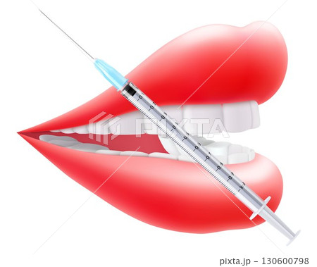 Vector illustration of pink lips with injection syringe. Perfect for beauty, makeup, and lip augmentation concept. Woman's kiss, a smile. Glossy and glamorous look. 3D realistic lips in vibrant color. Vector illustration of pink lips with injection syringe. Perfect for beauty, makeup, and lip augmentation concept. Woman's kiss, a smile. Glossy and glamorous look. 3D realistic lips in vibrant color. 130600798