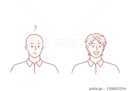 Hair loss and baldness concept. 130601034