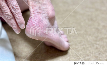 ガサガサのかかとに手をのばす高齢女性 130615365