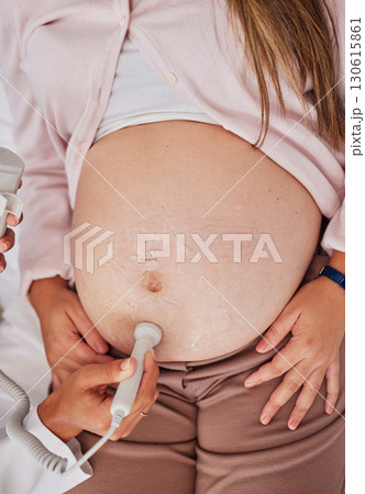 Stomach, doctor hands and ultrasound for pregnancy in hospital for health, wellness and family planning for future. Medic hand, pregnant woman and consulting with medical tech on abdomen for sonogram 130615861