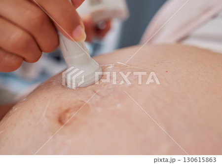 Doctor hand, ultrasound and pregnancy stomach for reading, health and family planning for future mother. Zoom closeup of medic, pregnant woman and sonogram with medical tech on abdomen for healthcare 130615863