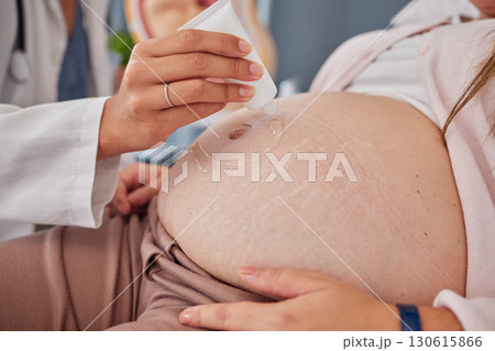 Pregnant, woman and stomach with gel, doctor and checkup for baby health, scan and appointment. Medical professional, pregnancy and female belly, ultrasound and confirm growth, healthcare or wellness Pregnant, woman and stomach with gel, doctor and checkup for baby health, scan and appointment. Medical professional, pregnancy and female belly, ultrasound and confirm growth, healthcare or wellness 130615866