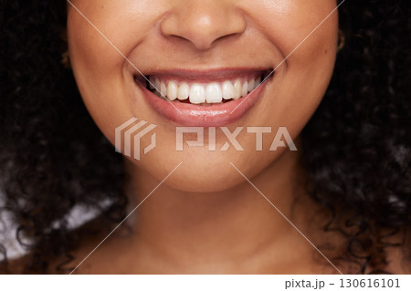 Black woman, teeth and smile for dental care, whitening or oral and mouth treatment. Closeup of happy African American female model smiling for dentist results, healthcare or clean tooth hygiene Black woman, teeth and smile for dental care, whitening or oral and mouth treatment. Closeup of happy African American female model smiling for dentist results, healthcare or clean tooth hygiene 130616101