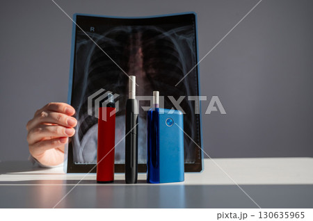 Doctor holds x-ray of lungs with e-cigarettes and vape in background. Doctor holds x-ray of lungs with e-cigarettes and vape in background. 130635965