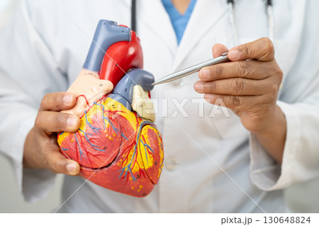 Cardiovascular disease CVD, Asian doctor holding human anatomy model for learn and treat heart disease. 130648824