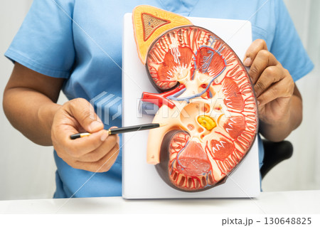 Kidney disease, Chronic kidney disease ckd, Doctor hold human model to treat and study in hospital. 130648825