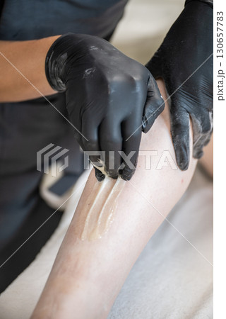 Beautician applying sugaring paste on female leg during professional hair removal procedure 130657783