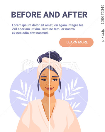 Before and after skincare treatment woman face split comparison healthy glowing skin towel headband robe botanical background pastel colors Before and after skincare treatment woman face split comparison healthy glowing skin towel headband robe botanical background pastel colors 130675349