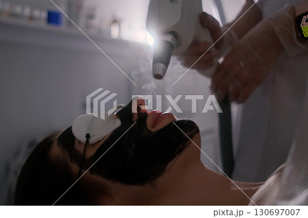 Close-up of a woman undergoing carbon laser facial treatment with protective goggles and a green laser light applied to the skin, a modern skincare procedure for deep cleansing and rejuvenation. 130697007