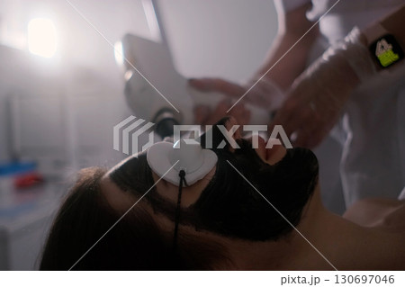 Close-up of a woman undergoing carbon laser facial treatment with protective goggles and a green laser light applied to the skin, a modern skincare procedure for deep cleansing and rejuvenation. 130697046