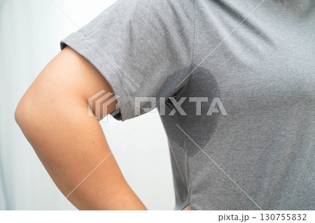 Asian woman have problem black armpit beauty skin care. Asian woman have problem black armpit beauty skin care. 130755832