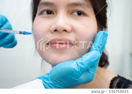 Asian woman receiving filler face beauty injection. Asian woman receiving filler face beauty injection. 130758035