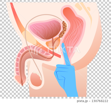 前立腺マッサージ位置 前立腺マッサージ位置 130768222