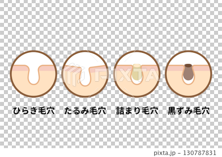 毛孔類型 130787831