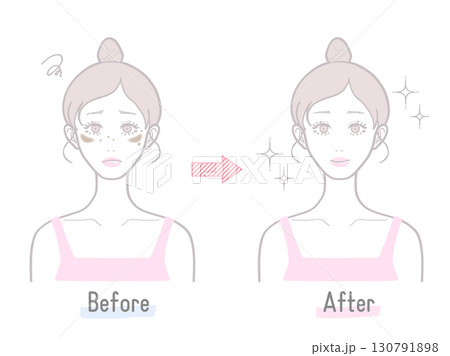 シミや肝斑など肌のビフォーアフター比較で伝える女性スキンケア効果イラスト 130791898