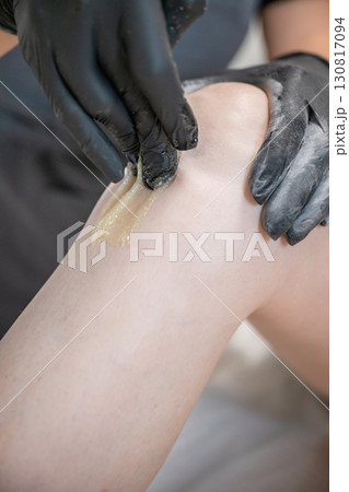 Beautician applying sugaring paste on female leg during professional hair removal procedure Beautician applying sugaring paste on female leg during professional hair removal procedure 130817094