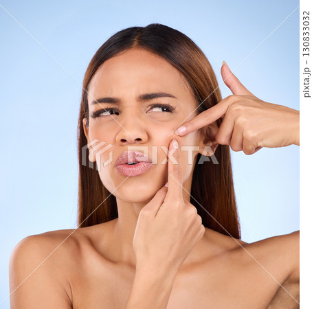 Beauty, cosmetics and woman squeeze pimple, skincare and girl with breakout against blue studio background. Female, lady and model with acne, grooming and treatment with facial scar and dermatology Beauty, cosmetics and woman squeeze pimple, skincare and girl with breakout against blue studio background. Female, lady and model with acne, grooming and treatment with facial scar and dermatology 130833032