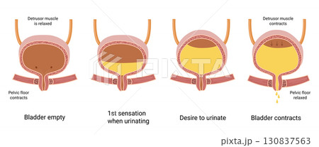 Human Bladder Anatomy. How The Bladder Works. Empty and full urinary bladder. The bladder muscles contract while the sphincter relaxes. Medical illustration 130837563