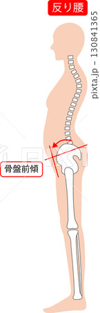 反り腰の女性　背骨と骨盤 130841365