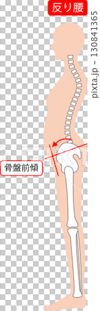 反り腰の女性　背骨と骨盤 130841365