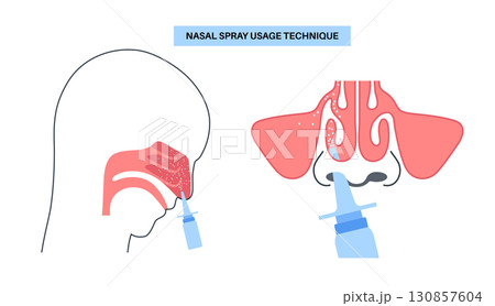 Proper nasal spray usage 130857604