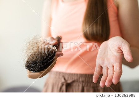 Upset woman holding her brush with long loss hair. Closeup, selective focus. Upset woman holding her brush with long loss hair. Closeup, selective focus. 130862999