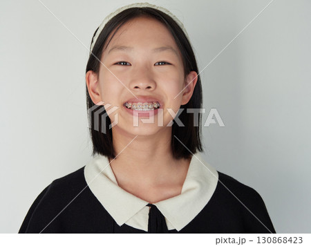 子供が楽しく歯の矯正の口の様子を見せます 子供が楽しく歯の矯正の口の様子を見せます 130868423