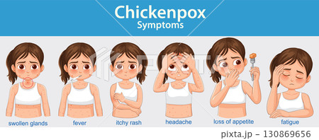 Chickenpox Symptoms Illustrated in Children with Facial Expressions Chickenpox Symptoms Illustrated in Children with Facial Expressions 130869656