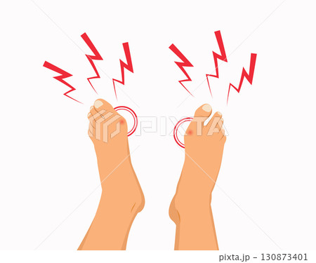 Male Feet Feeling Pain Cartoon Vector Illustration Male Feet Feeling Pain Cartoon Vector Illustration 130873401