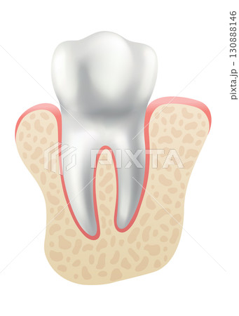 Dental implant. Medical educative infographic poster. Teeth implant, realistic vector design of dentistry. Healthcare, dentist and orthodontist treatment 130888146