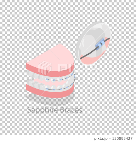 3D Isometric Flat  Illustration of Dental Teeth Braces Types. Item 5 130895427