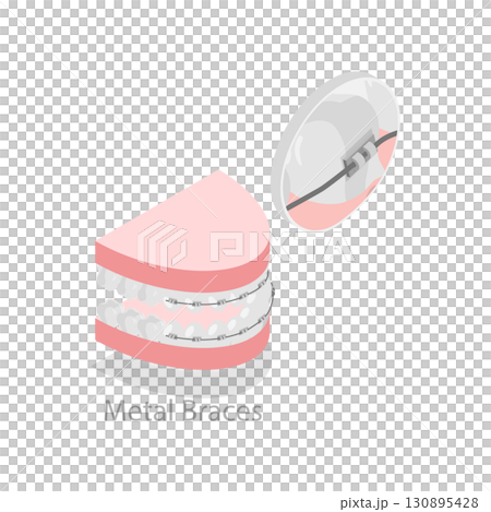 3D Isometric Flat Illustration of Dental Teeth Braces Types. Item 6 3D Isometric Flat Illustration of Dental Teeth Braces Types. Item 6 130895428